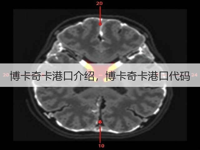 博卡奇卡港口介绍，博卡奇卡港口代码(图2)